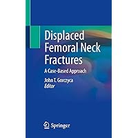 Displaced Femoral Neck Fractures: A Case-Based Approach Displaced Femoral Neck Fractures: A Case-Based Approach Kindle Paperback