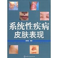 Skin manifestations of systemic disease(Chinese Edition)