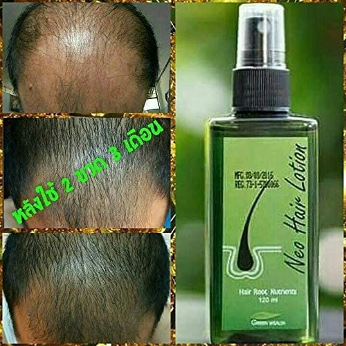 Mua Neo Hair Lotion 120ml Hair Treatment Hair Root nutrients (Pack of 3) by  TDS trên Amazon Mỹ chính hãng 2023 | Giaonhan247