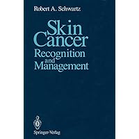 Skin Cancer: Recognition and Management Skin Cancer: Recognition and Management Kindle Paperback Hardcover Digital