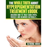 The Whole Truth about Hyperpigmentation Treatment eBook: Discover How to Treat Dark Spots, Freckles and Blemishes Naturally The Whole Truth about Hyperpigmentation Treatment eBook: Discover How to Treat Dark Spots, Freckles and Blemishes Naturally Kindle