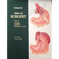 Atlas of Surgery: The Esophagus, the Stomach, the Duodenum, the Spleen, Laparoscopic Cholecystectomy Atlas of Surgery: The Esophagus, the Stomach, the Duodenum, the Spleen, Laparoscopic Cholecystectomy Hardcover