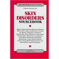 Skin Disorders Sourcebook: Basic Information About Common Skin and Scalp Conditions Caused by Aging, Allergies, Immune Reactions, Sun Exposure, ... Parasites, (22) (Health Reference Series) Skin Disorders Sourcebook: Basic Information About Common Skin and Scalp Conditions Caused by Aging, Allergies, Immune Reactions, Sun Exposure, ... Parasites, (22) (Health Reference Series) Hardcover