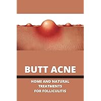 Butt Acne: Home And Natural Treatments For Folliculitis: Barber'S Itch Home Remedies