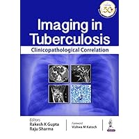 Imaging in Tuberculosis: Clinicopathological Correlation Imaging in Tuberculosis: Clinicopathological Correlation Kindle Paperback
