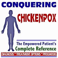 2009 Conquering Chickenpox - The Empowered Patient's Complete Reference - Diagnosis, Treatment Options, Prognosis (Two CD-ROM Set) 2009 Conquering Chickenpox - The Empowered Patient's Complete Reference - Diagnosis, Treatment Options, Prognosis (Two CD-ROM Set) Multimedia CD