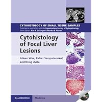 Cytohistology of Focal Liver Lesions (Cytohistology of Small Tissue Samples) Cytohistology of Focal Liver Lesions (Cytohistology of Small Tissue Samples) Kindle Hardcover