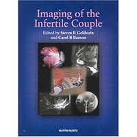 Imaging in the Infertile Couple