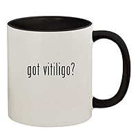 got vitiligo? - 11oz Ceramic Colored Handle and Inside Coffee Mug Cup, Black