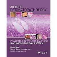 Atlas of Dermatopathology: Practical Differential Diagnosis by Clinicopathologic Pattern Atlas of Dermatopathology: Practical Differential Diagnosis by Clinicopathologic Pattern Kindle Hardcover