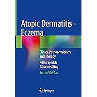 Atopic Dermatitis - Eczema: Clinics, Pathophysiology and Therapy Atopic Dermatitis - Eczema: Clinics, Pathophysiology and Therapy Hardcover Kindle