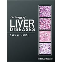Pathology of Liver Diseases Pathology of Liver Diseases Kindle Hardcover
