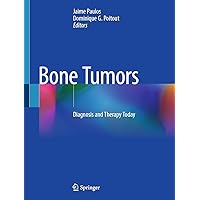 Bone Tumors: Diagnosis and Therapy Today Bone Tumors: Diagnosis and Therapy Today Kindle Hardcover