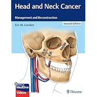 Head and Neck Cancer: Management and Reconstruction Head and Neck Cancer: Management and Reconstruction Kindle Hardcover