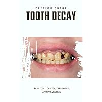 TOOTH DECAY: Symptoms, Causes, Treatment, and Prevention TOOTH DECAY: Symptoms, Causes, Treatment, and Prevention Kindle Paperback