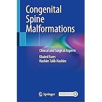 Congenital Spine Malformations: Clinical and Surgical Aspects Congenital Spine Malformations: Clinical and Surgical Aspects Hardcover