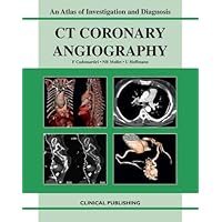 CT Coronary Angiography: An Atlas of Investigation and Diagnosis CT Coronary Angiography: An Atlas of Investigation and Diagnosis Hardcover