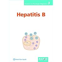 Hepatitis B (Spanish Edition) Hepatitis B (Spanish Edition) Kindle Hardcover