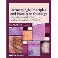 Dermatologic Principles and Practice in Oncology: Conditions of the Skin, Hair, and Nails in Cancer Patients Dermatologic Principles and Practice in Oncology: Conditions of the Skin, Hair, and Nails in Cancer Patients Kindle Hardcover