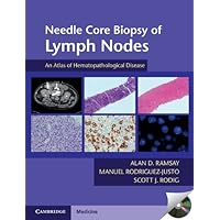 Needle Core Biopsy of Lymph Nodes with DVD-ROM: An Atlas of Hematopathological Disease Needle Core Biopsy of Lymph Nodes with DVD-ROM: An Atlas of Hematopathological Disease Paperback