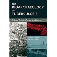 The Bioarchaeology of Tuberculosis: A Global View on a Reemerging Disease The Bioarchaeology of Tuberculosis: A Global View on a Reemerging Disease Hardcover Paperback
