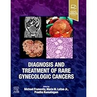 Diagnosis and Treatment of Rare Gynecologic Cancers Diagnosis and Treatment of Rare Gynecologic Cancers Hardcover Kindle