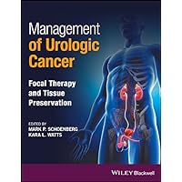 Management of Urologic Cancer: Focal Therapy and Tissue Preservation Management of Urologic Cancer: Focal Therapy and Tissue Preservation Kindle Hardcover