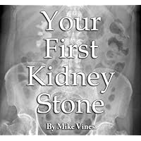Your First Kidney Stone Your First Kidney Stone Kindle