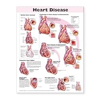 Heart Disease Anatomical Chart