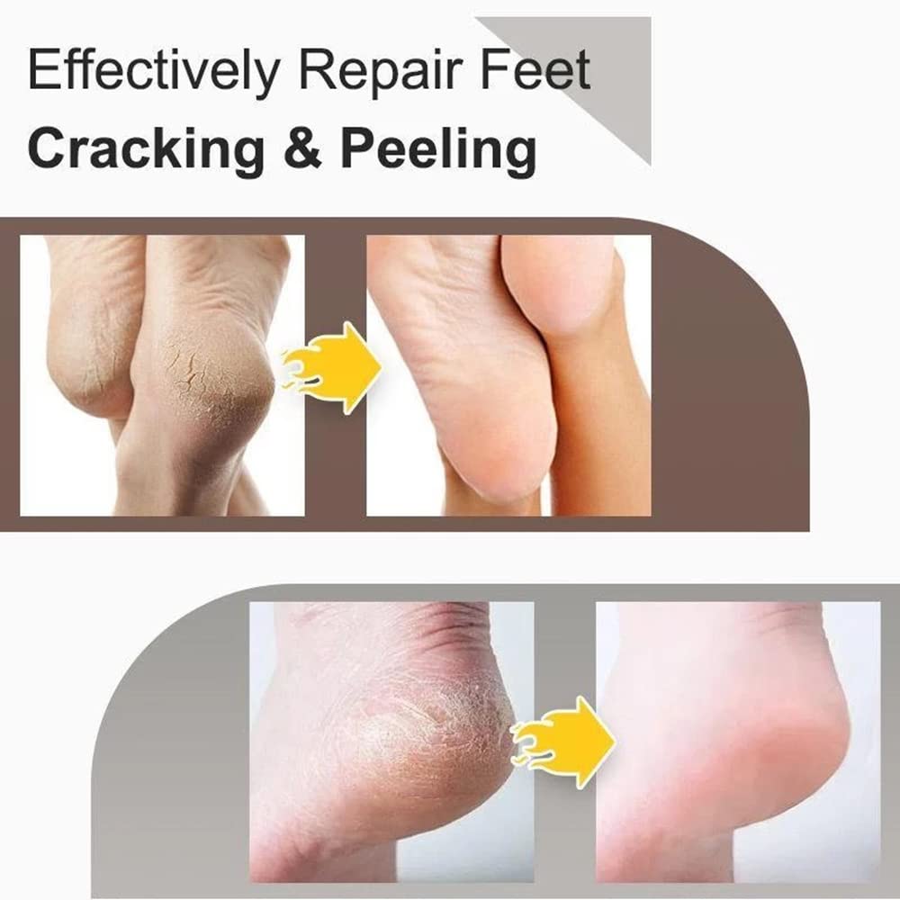 SURORAIN Foot Repair Cream,Moisturizing Foot Cream For Dry Cracked Heels Callus Remover Hand Cream Foot Cream Advanced Repair Cream Body Moisturizer for Very Dry Skin 0.53 Ounce