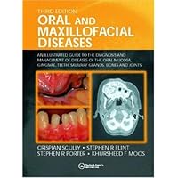 Oral and Maxillofacial Diseases: An Illustrated Guide to Diagnosis and Management of Diseases of the Oral Mucosa, Gingivae, Teeth, Salivary Glands, Bones, and Joints Oral and Maxillofacial Diseases: An Illustrated Guide to Diagnosis and Management of Diseases of the Oral Mucosa, Gingivae, Teeth, Salivary Glands, Bones, and Joints Hardcover