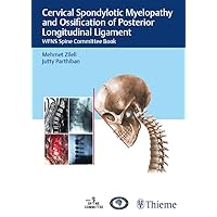 Cervical Spondylotic Myelopathy and Ossification of Posterior Longitudinal Ligament: WFNS Spine Committee Book Cervical Spondylotic Myelopathy and Ossification of Posterior Longitudinal Ligament: WFNS Spine Committee Book Kindle Hardcover