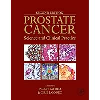 Prostate Cancer: Science and Clinical Practice Prostate Cancer: Science and Clinical Practice Kindle Hardcover