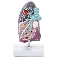 Teaching Model,Lung Cancer Model Pathology Lung Model 3D Human Lung Anatomical Model wirh Clear Texture & Accurate Anatomy Structure for Teaching Models Doctor-Patient Communicatio