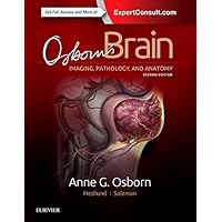 Osborn's Brain Osborn's Brain Hardcover Kindle