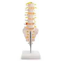 NSKI Medical Human Spine Pathology Demonstration Model Anatomical Model