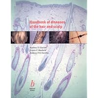 Handbook of Diseases of the Hair and Scalp Handbook of Diseases of the Hair and Scalp Paperback