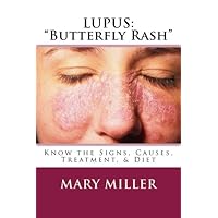 Lupus Butterfly Rash: Know the Signs, Causes, Treatment, & Diet Lupus Butterfly Rash: Know the Signs, Causes, Treatment, & Diet Paperback