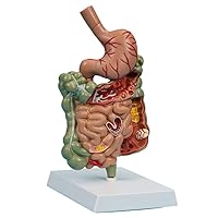 Removerable Teaching Model Human Stomach Anatomy Model Pathological Digestive System Model Stomach Section Large Small Intestine Medical Model Anatomy