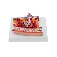 Anatomical Fetal Membrane Placenta Model Human Placenta Anatomy Model for Doctor Patient Communication Diseases Study Basal Decidua