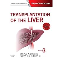 Transplantation of the Liver Transplantation of the Liver Hardcover Kindle