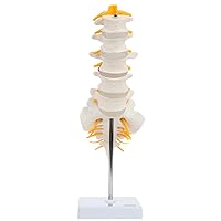 Axis Scientific Lumbar Spine Anatomy Model with Sacrum and Spinal Nerves, Didactic Replica Demonstrates Lumbrosacral Section with Nerves and A Herniated Disc At L4 - Includes Base for Display and