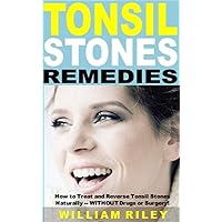 Tonsil Stones Remedies: How to Treat and Reverse Tonsil Stones Naturally -- WITHOUT Drugs or Surgery!