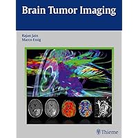 Brain Tumor Imaging Brain Tumor Imaging Kindle Hardcover