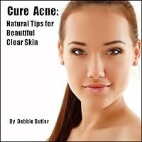 Cure Acne: Natural Tips for Beautiful Clear Skin (Easy Simple Remedies Book 3) Cure Acne: Natural Tips for Beautiful Clear Skin (Easy Simple Remedies Book 3) Kindle