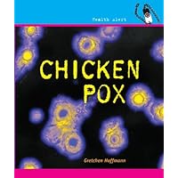 Chicken Pox (Health Alert) Chicken Pox (Health Alert) Library Binding