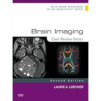 Brain Imaging: Case Review Series Brain Imaging: Case Review Series eTextbook Paperback Mass Market Paperback