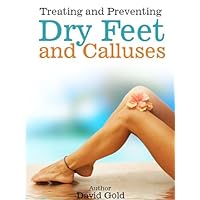 Treating And Preventing Dry Feet and Calluses How To Remove Calluses From Feet - Pedi Spin Callus Remover Treating And Preventing Dry Feet and Calluses How To Remove Calluses From Feet - Pedi Spin Callus Remover Kindle