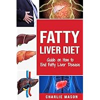 Fatty Liver Diet: Guide on How to End Fatty Liver Disease: Fatty Liver Diet Books Fatty Liver Diet: Guide on How to End Fatty Liver Disease: Fatty Liver Diet Books Paperback Kindle Hardcover