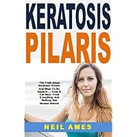 Keratosis Pilaris: The Truth About Keratosis Pilaris And What To Do About It ... Even If You Have Tried Everything And Nothing Has Worked Before!